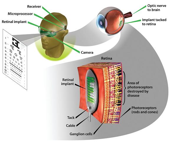 Artificial Retina Project Screencap